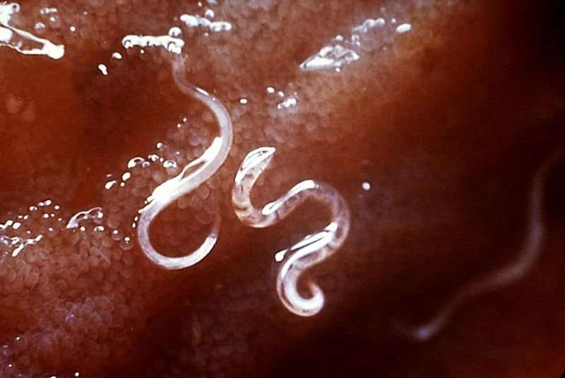 改变肠道微生物组只有一个子集的helminth-infected病人