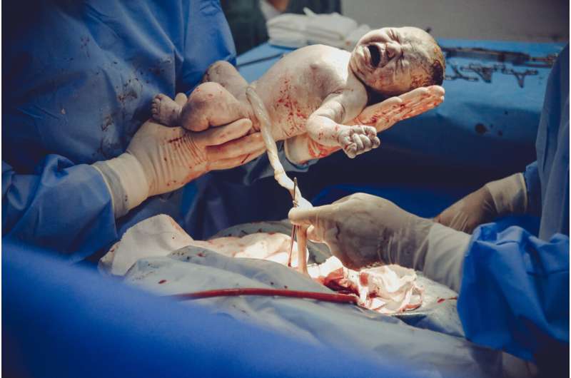 Clamping the umbilical cord straight after birth is bad for a baby's health