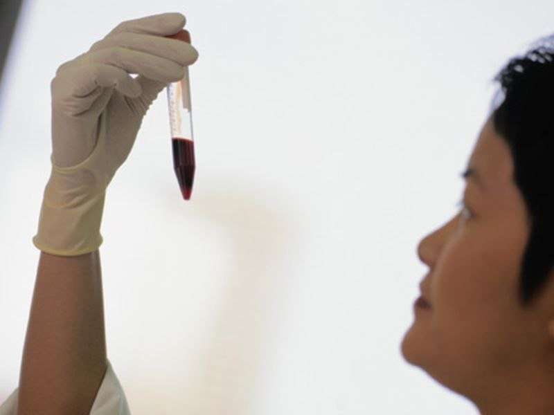 血液测试能发现早期结肠癌?