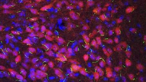 Creation of new brain cells may be limited, mouse study shows