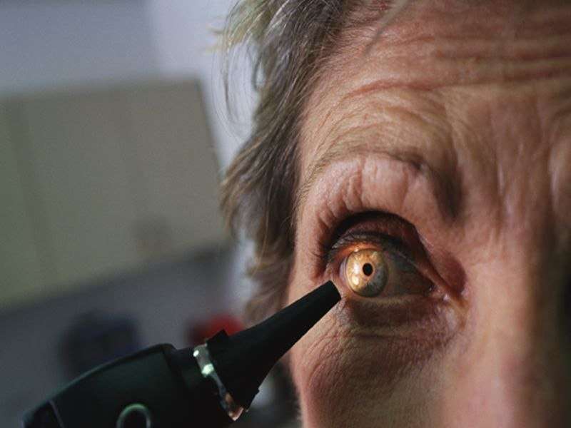 Decline in new cases of blindness in germany