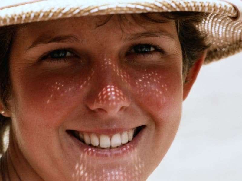 Dermatologist intervention tied to better sun protection