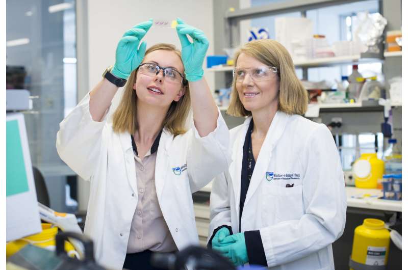 Discovery paves way for improved ovarian cancer care