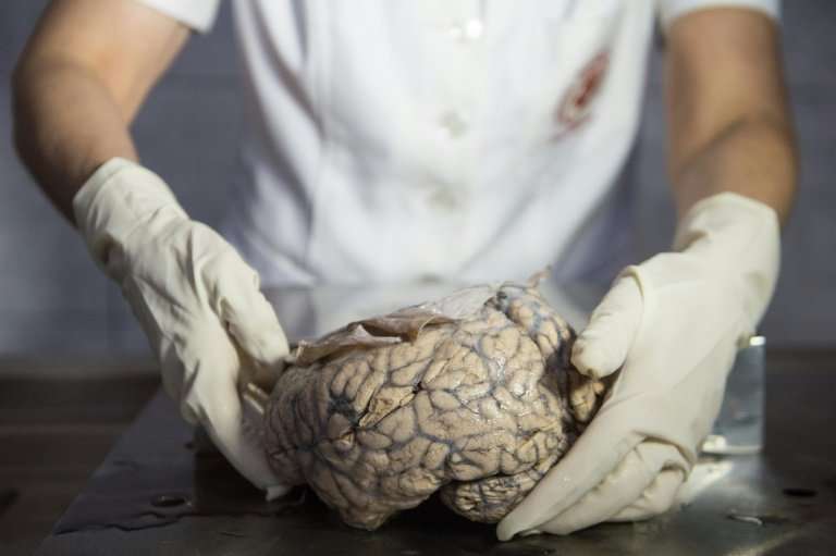 Dr Diana Rivas displays a human brain on a working surface at the &quot;Museum of Neuropathology&quot; in Lima, Peru