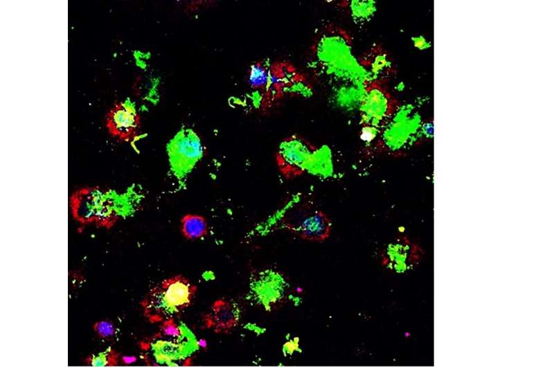 Eat 'em up: Next-generation therapeutic helps immune cells detect, destroy cancer