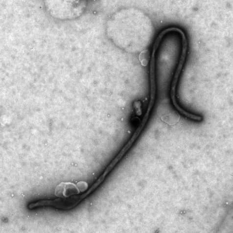 Ebola virus exploits host enzyme for efficient entry to target cells