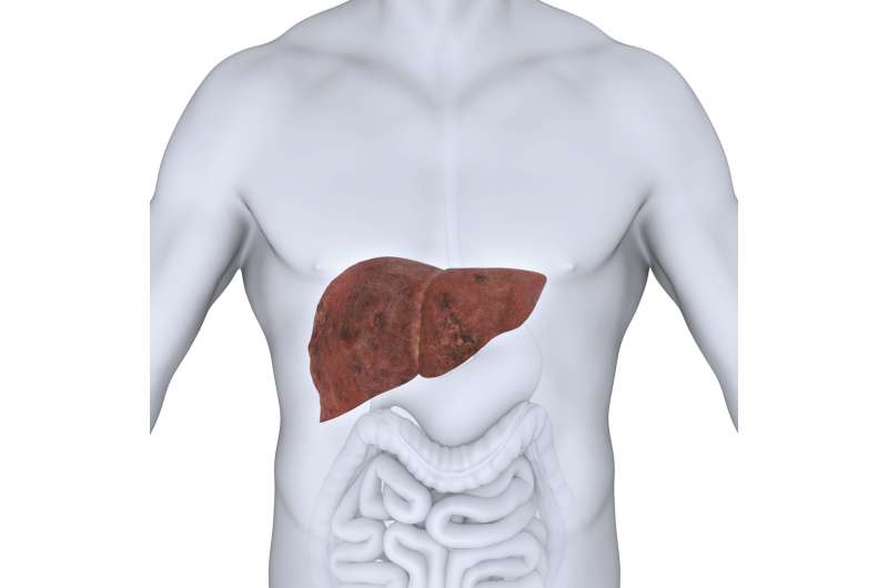 Economic burden of fatty liver disease in US is $32 billion annually, new study finds