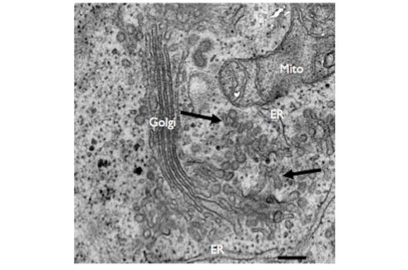 Enzyme found to control formation of collagen carriers and inhibit collagen secretion