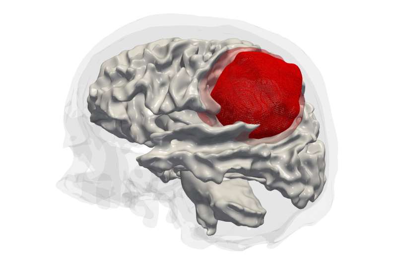 Epigenetic analysis of aggressive brain tumors