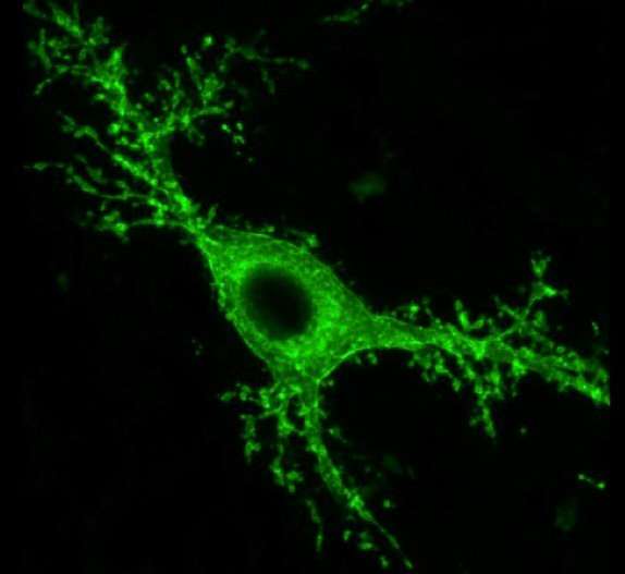 Epilepsy study links mossy brain cells to seizures and memory loss