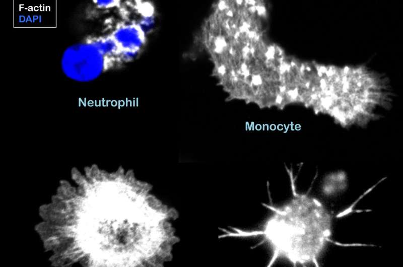 Faulty cytoskeleton impairs immune cells