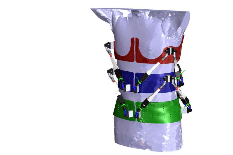 First dynamic spine brace -- robotic spine exoskeleton -- characterizes spine deformities