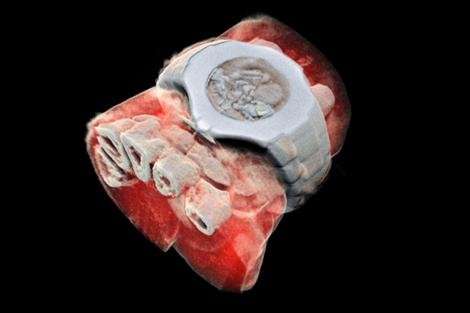 First human scanned with next-generation 3-D colour medical scanner