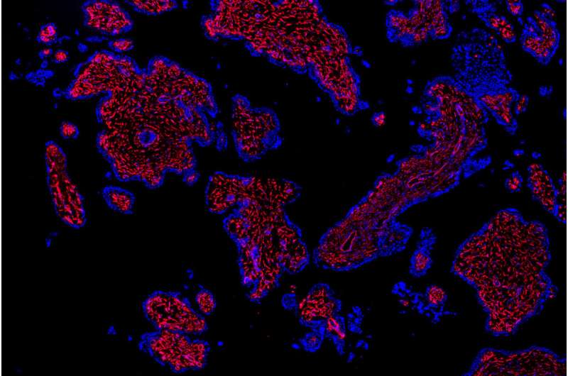 First mapping of cells in the early human placenta to advance research on problem pregnancies