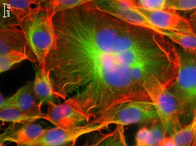 First study on physical properties of giant cancer cells may inform new treatments