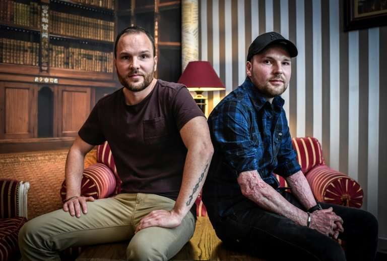Franck Dufourmantelle (R), 34, received skin grafts from his twin brother Eric after suffering burns to 95 percent of his body