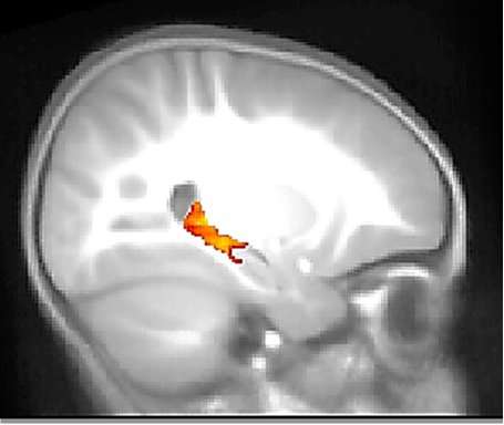 功能性核磁共振成像揭示了熟睡幼儿的记忆