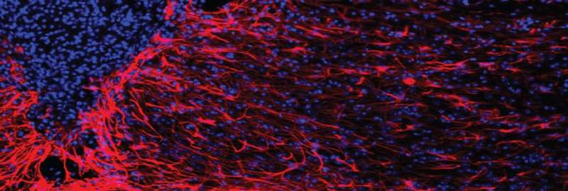 Gene therapy may help brain heal from stroke, other injuries