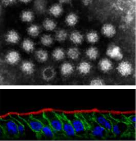 Going viral: New cells for norovirus production in the lab