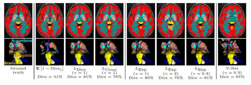 Helping to improve medical image analysis with deep learning