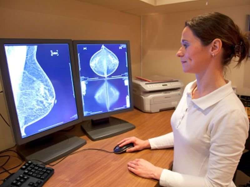 Higher biopsy rates for women undergoing screening breast MRI