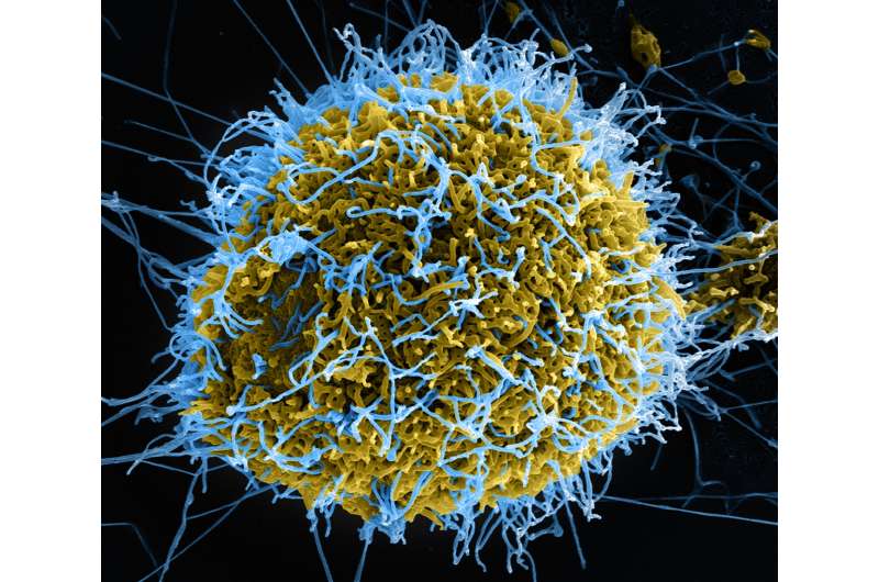 How the human immune system protects against Ebola