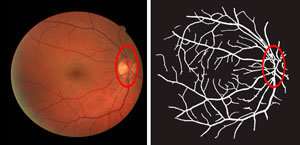 Image processing algorithm shows promise for mapping the blood vessel networks in the eye