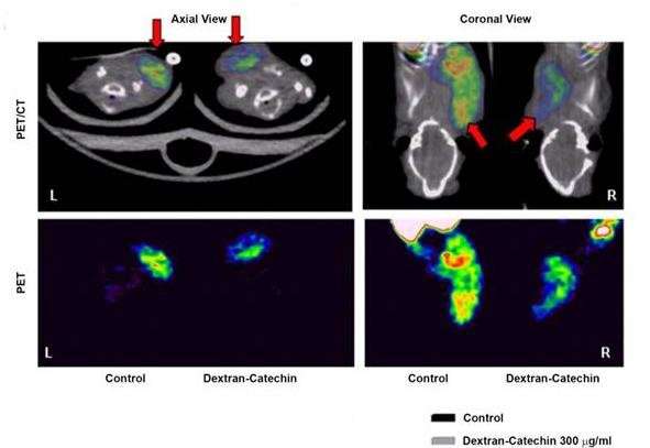 Imaging protocol assesses molecular mechanism of work in the treatment of deadly childhood cancer neuroblastoma