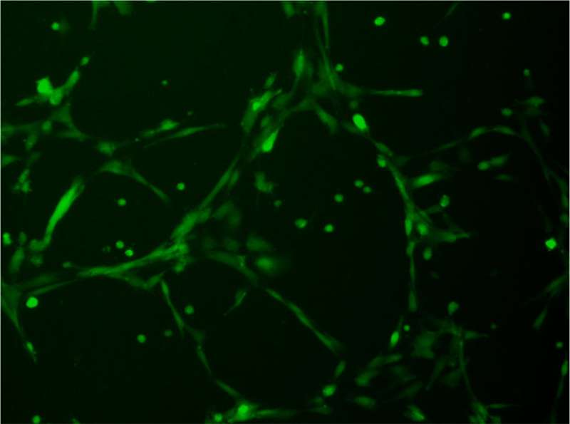 In effort to treat rare blinding disease, researchers turn stem cells into blood vessels