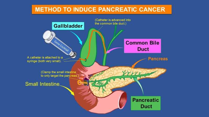 Injecting gene cocktail into mouse pancreas leads to humanlike tumors