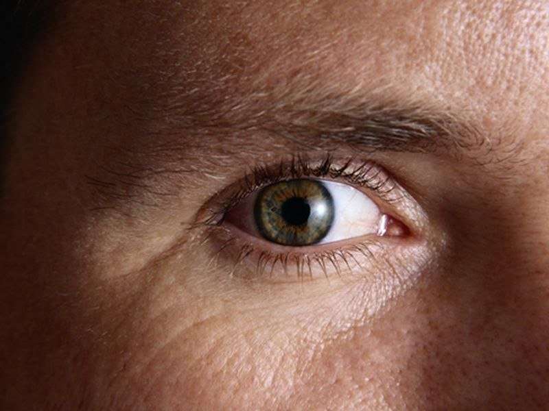 In retinoblastoma survivors, oculo-visual issues tied to QoL