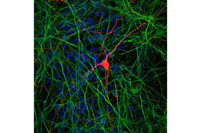 Interconnected cells-in-a-dish let researchers study brain disease