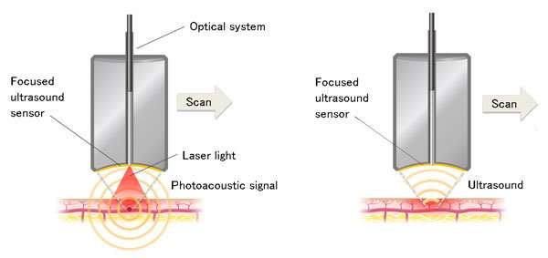 In vivo skin imaging technology developed