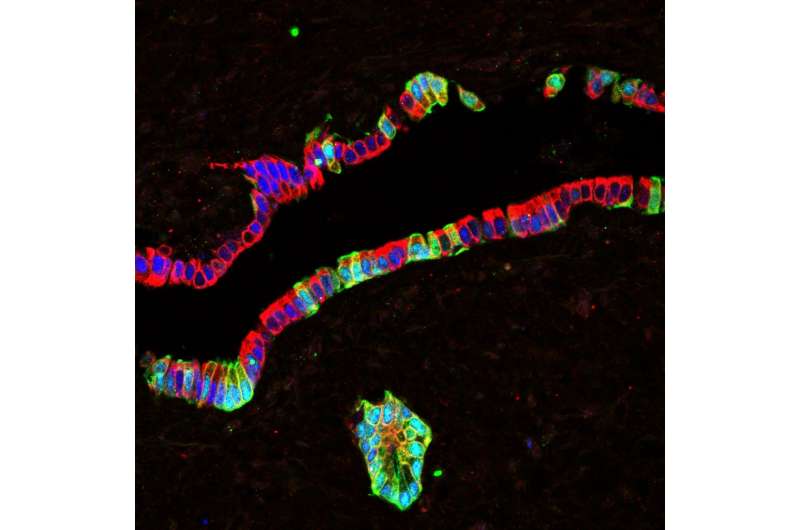 Is the pancreas regeneration debate settled? An original theory renewed