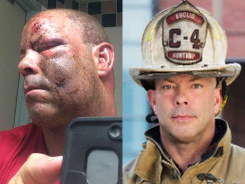 July 4 fireworks nearly cost this fireman his life