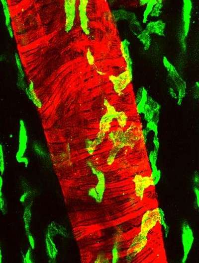 Key to artery health lies in LYVE-1 macrophage
