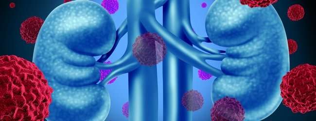 肾脏癌捕获从其他细胞类型窃取基因以传播