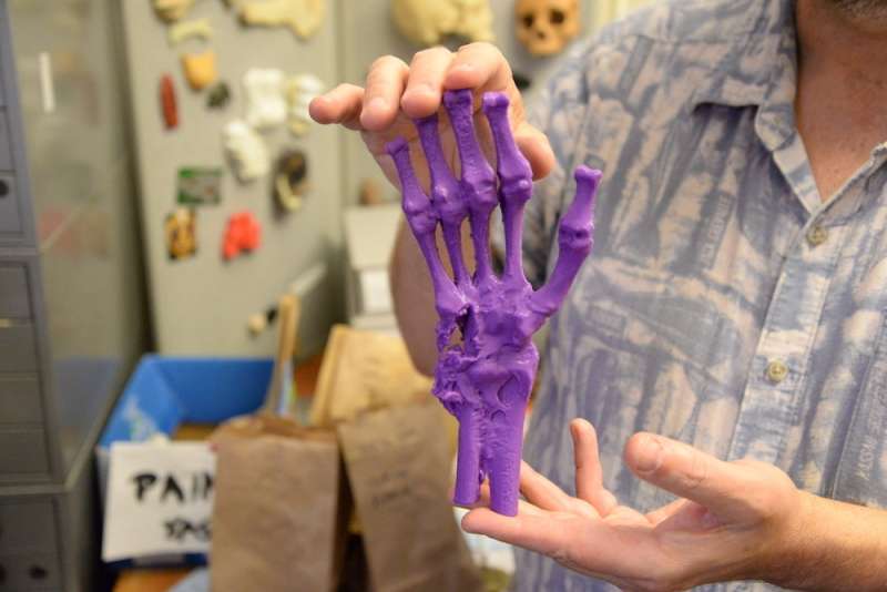 Lab 3-D scans human skeletal remains dating back to the civil war