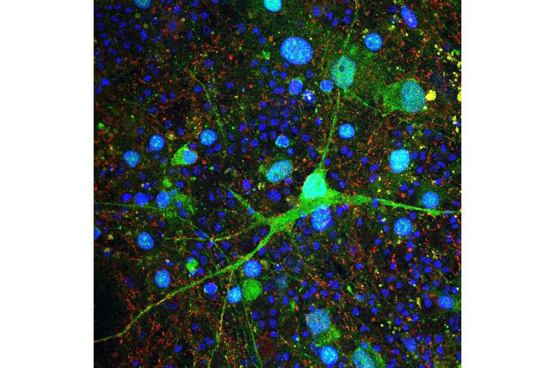 Lab-grown human cerebellar cells yield clues to autism