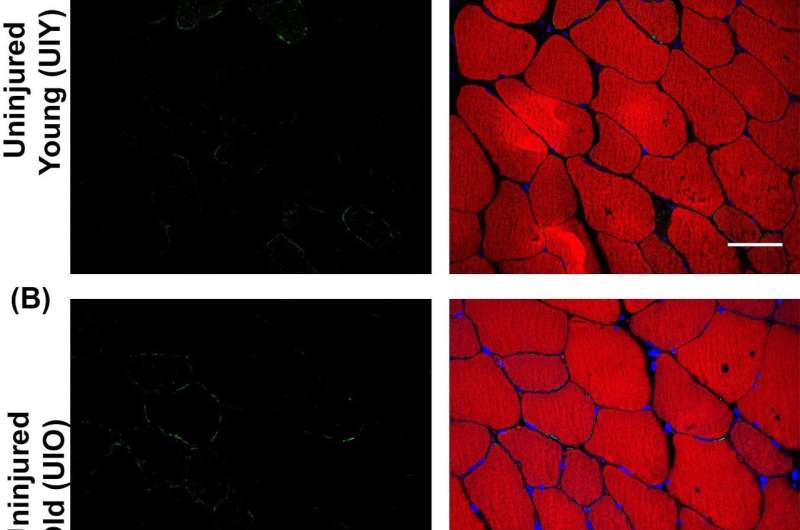 'Longevity Protein' rejuvenates muscle healing in old mice