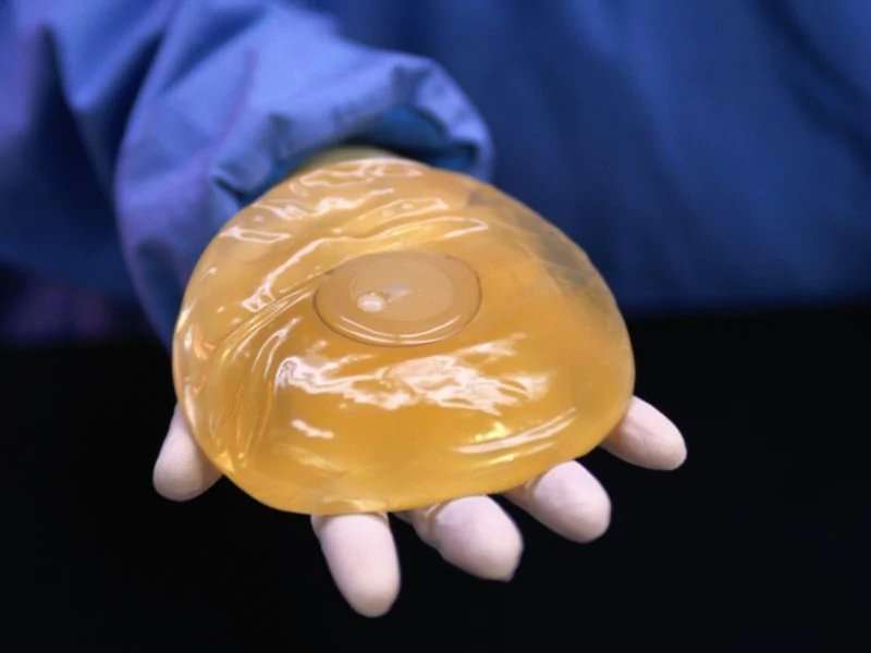 Long-term outcomes of breast implants explored