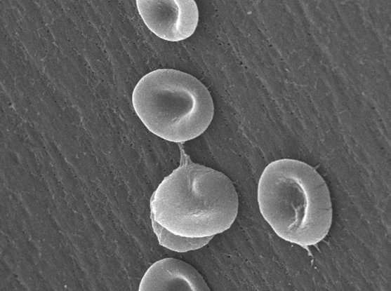 Looking beyond genes to explain blood cells' fates