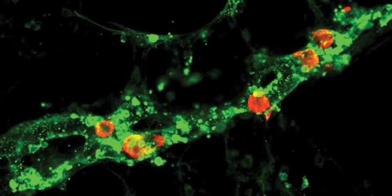 Lymphatic vessels unexpectedly promote the spread of cancer metastases