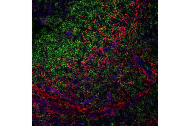 Lymph node structural cells rein in human immune responses