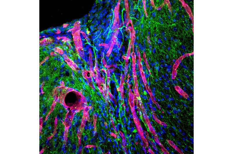 Mice regrow brain tissue after stroke with bioengineered gel
