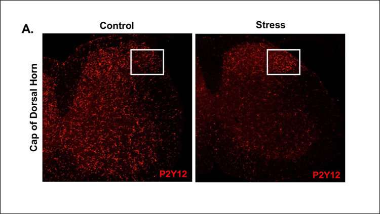 Microglia transmit pain to the brain during stress
