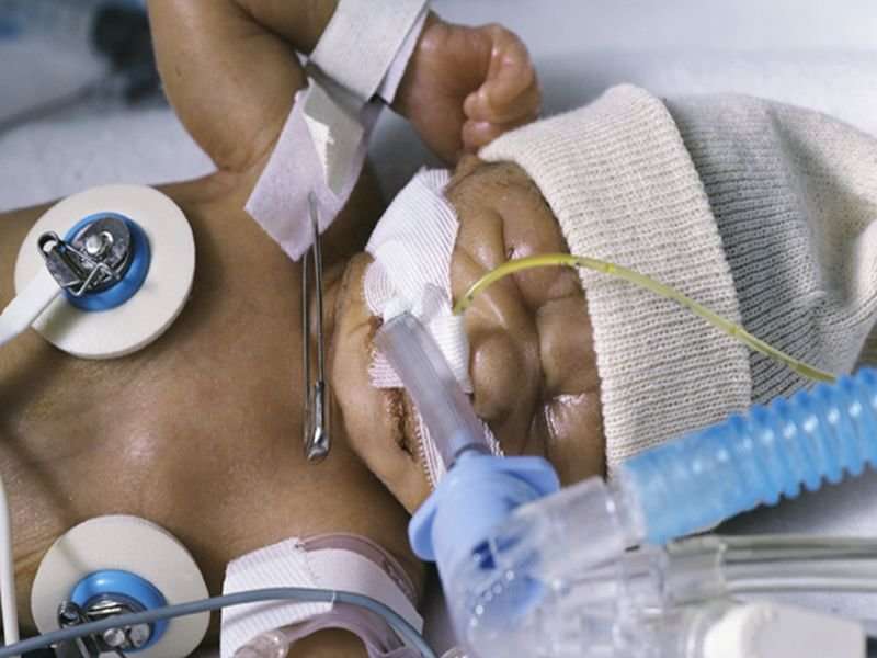 Most premature infants receive early antibiotics