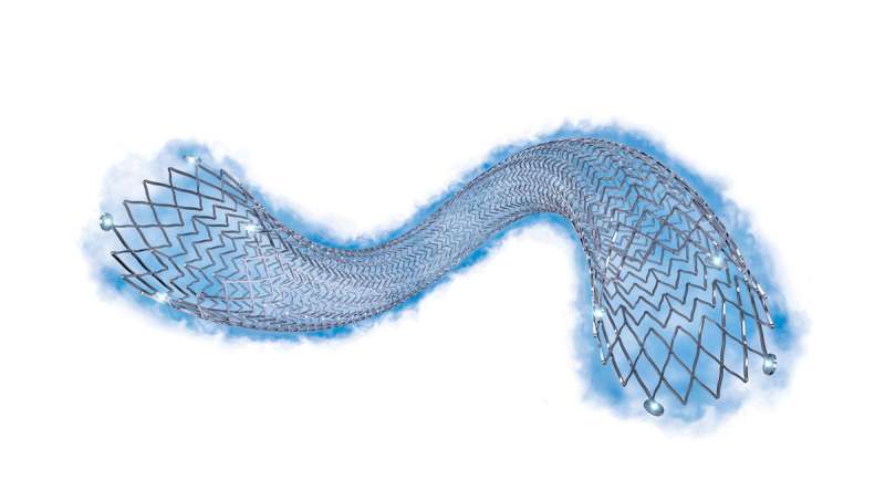 Mount Sinai is first to use FDA-approved drug-eluting stent that treats PAD