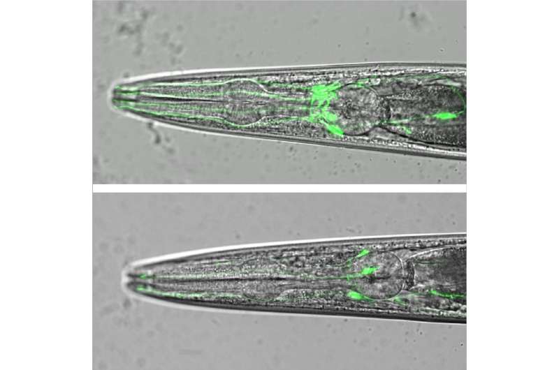 Mutation of worm gene, swip-10, triggers age-dependent death of dopamine neurons