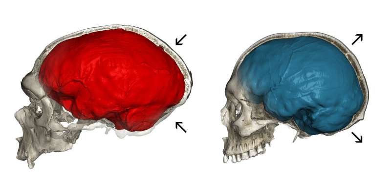 Neandertal genes give clues to human brain evolution